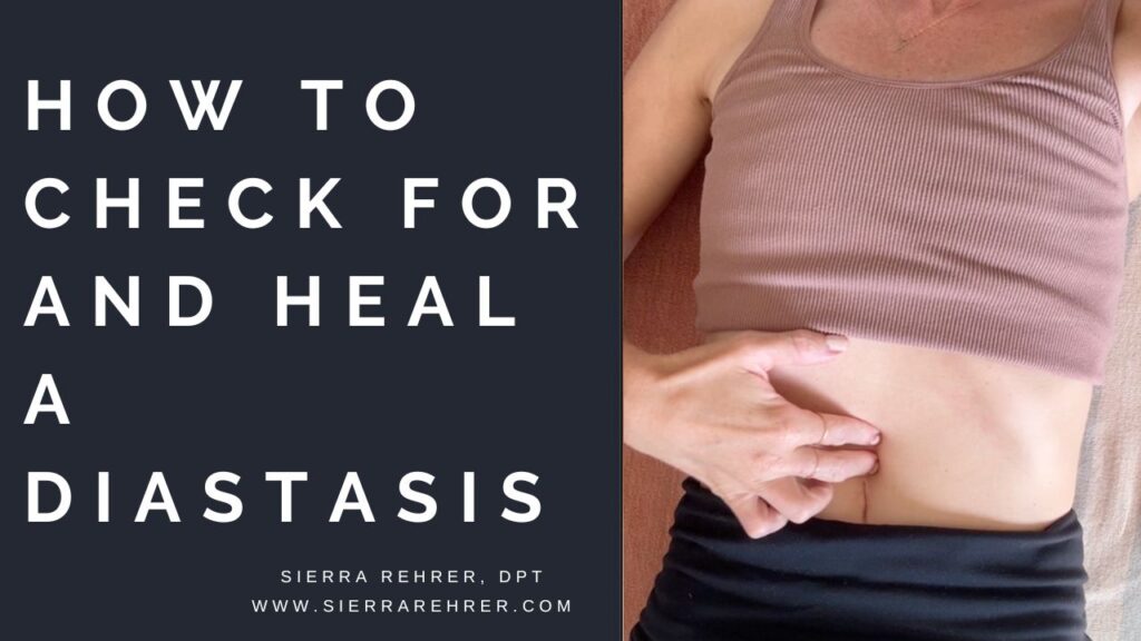 How to check for a diastasis 